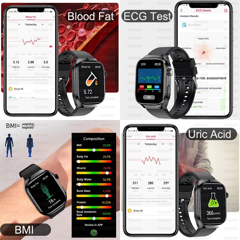 Xiaomi Five organ examination Smart Watch Men Women ECG+PPG Uric Acid Blood Fat
